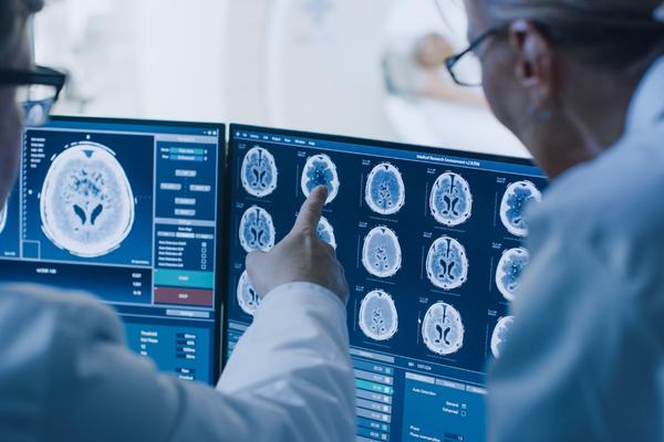 doctor reviewing brain scan images